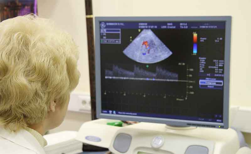 10 facts about ultrasound